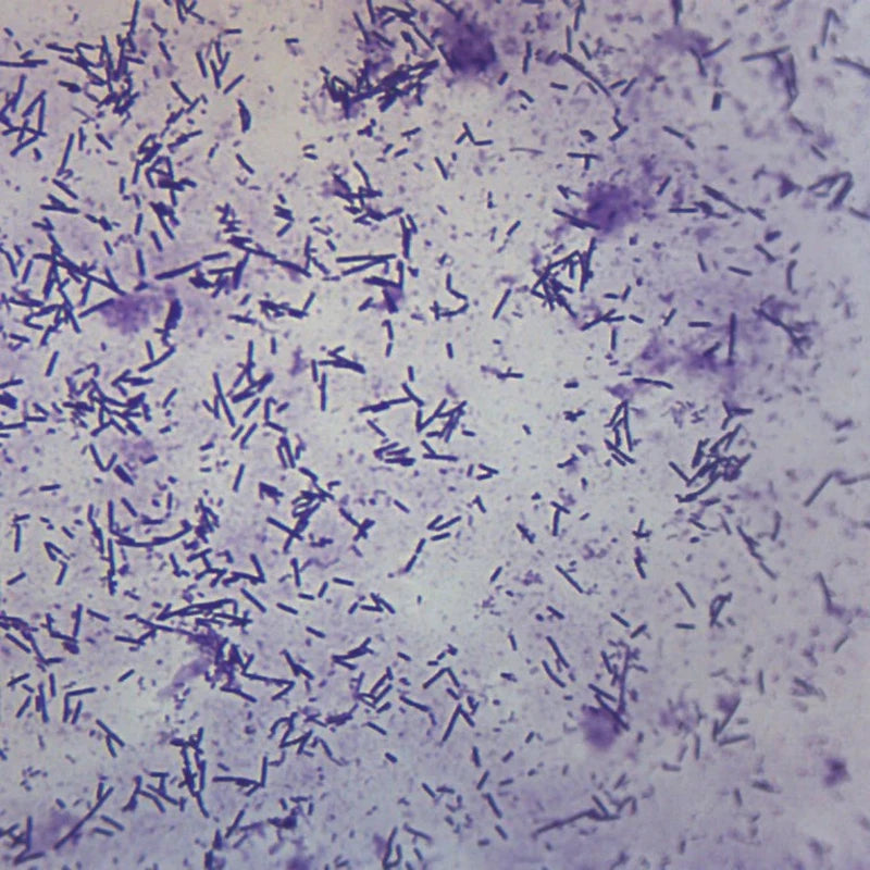 E. coli bacteria