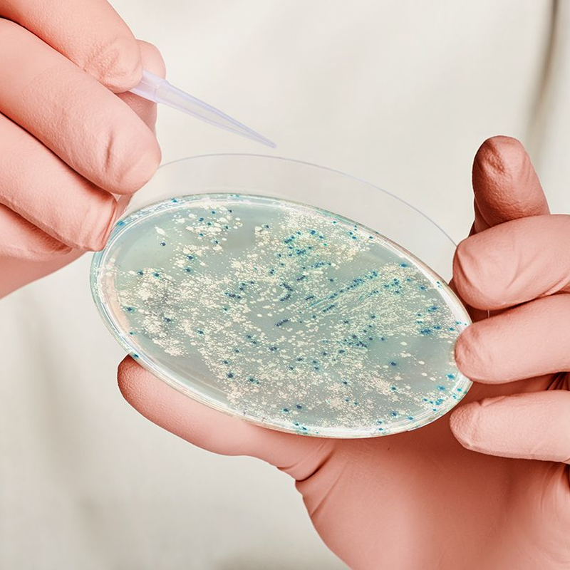 Preventing E. coli Infections Essential Food Safety Milerd