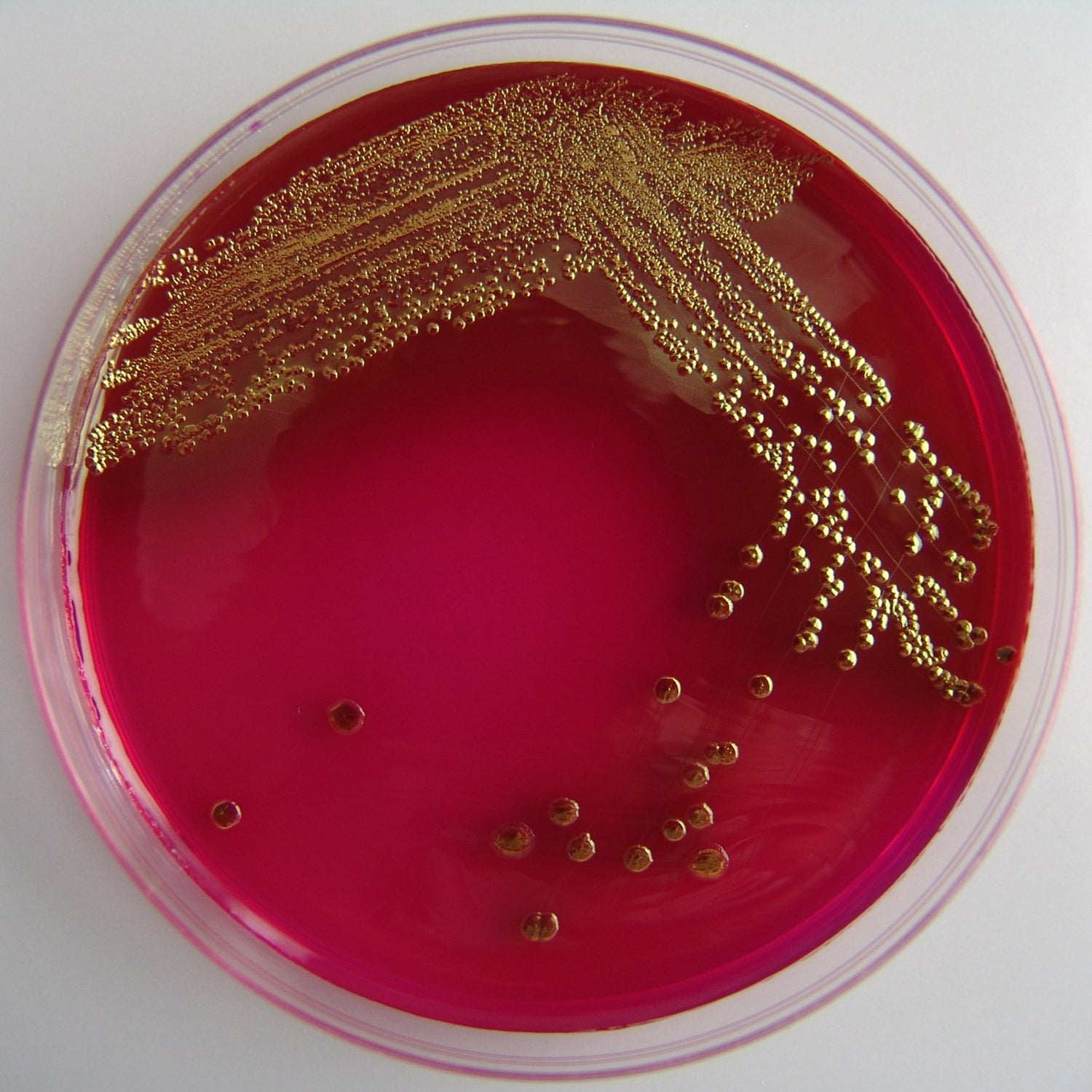 E. coli bacteria