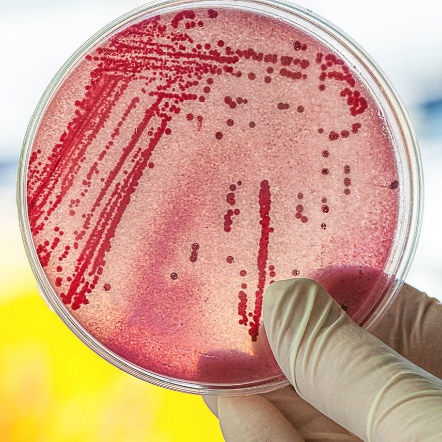 E. coli bacteria